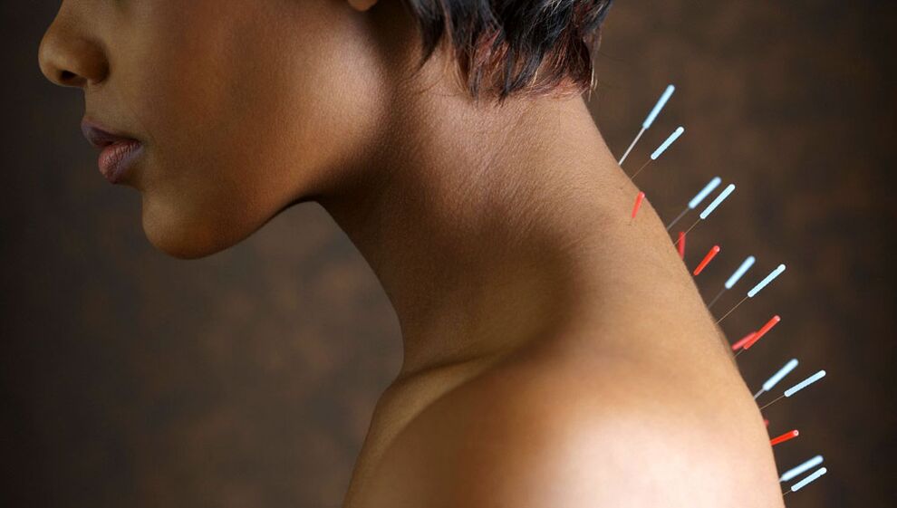 ការចាក់ម្ជុលវិទ្យាសាស្ត្រជាមួយនឹងជំងឺរលាកសន្លាក់មាត់ស្បូន