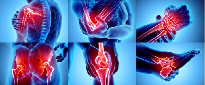 សន្លាក់រលាក